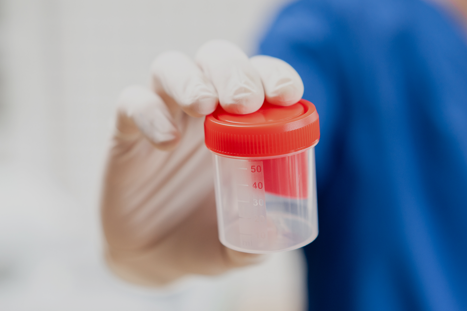 Close-up of a gloved hand holding a urine specimen cup for an MMC drug test.